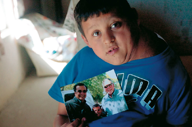 Dünyanın en garip hastalıkları 38