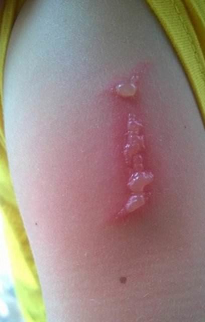 Dünyanın en garip hastalıkları 40