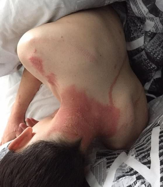 Dünyanın en garip hastalıkları 41