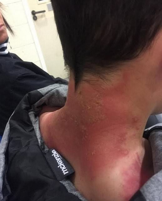 Dünyanın en garip hastalıkları 42