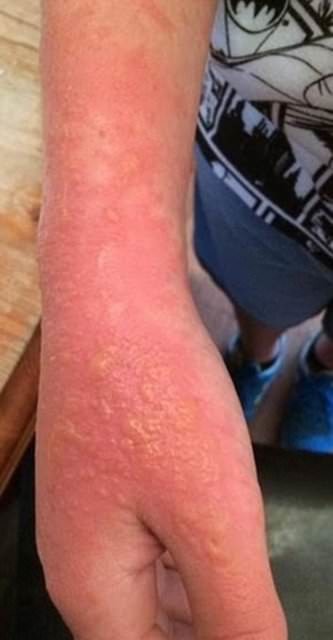 Dünyanın en garip hastalıkları 43