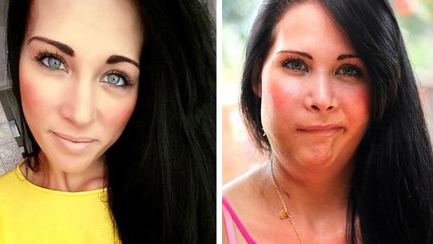 Dünyanın en garip hastalıkları 48