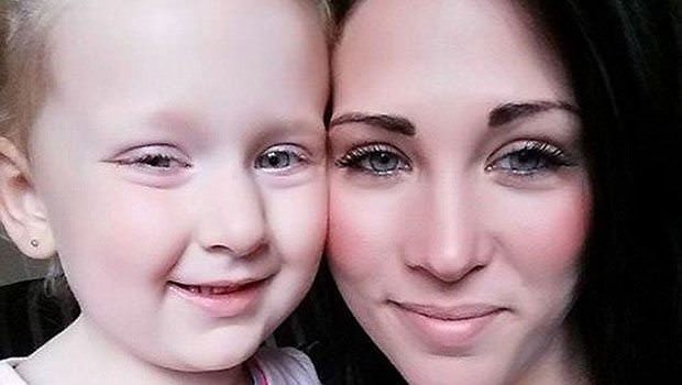 Dünyanın en garip hastalıkları 49