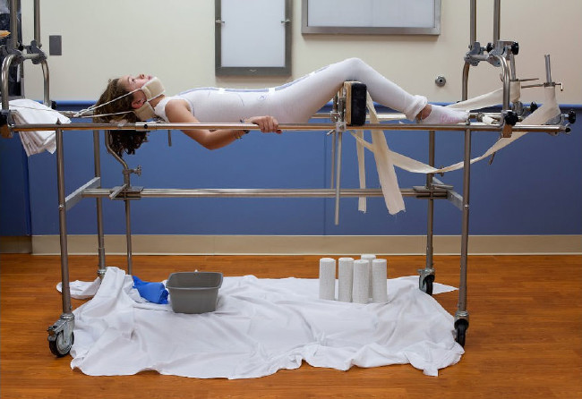 Dünyanın en garip hastalıkları 51