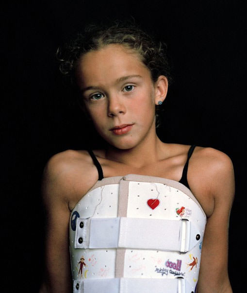 Dünyanın en garip hastalıkları 52