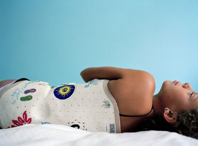 Dünyanın en garip hastalıkları 53