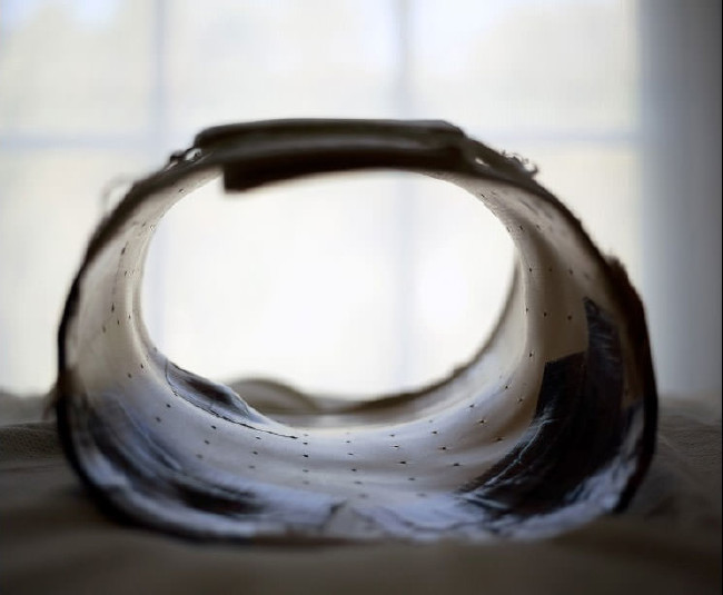 Dünyanın en garip hastalıkları 54