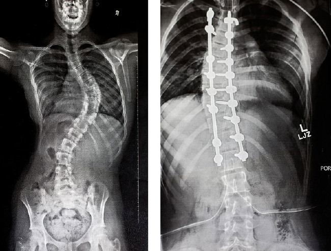 Dünyanın en garip hastalıkları 55