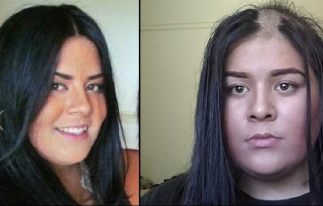 Dünyanın en garip hastalıkları 56