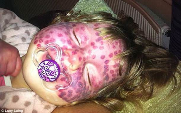 Dünyanın en garip hastalıkları 3