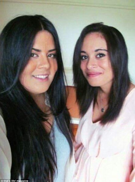 Dünyanın en garip hastalıkları 57