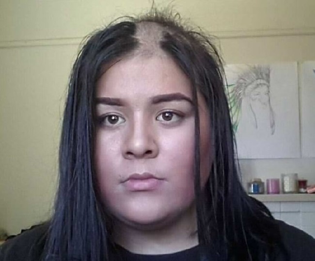 Dünyanın en garip hastalıkları 58