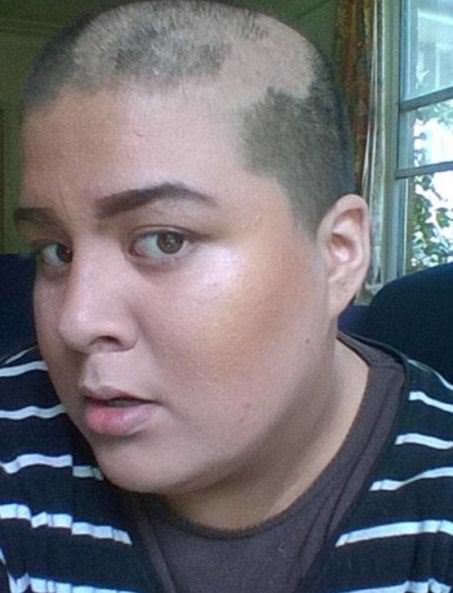 Dünyanın en garip hastalıkları 59