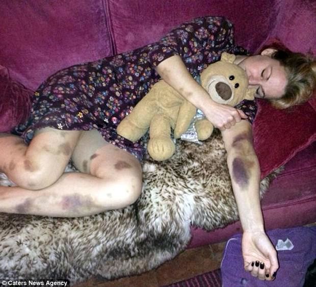 Dünyanın en garip hastalıkları 60