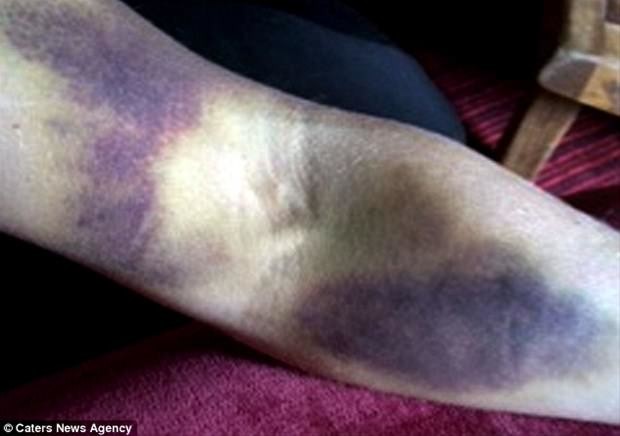 Dünyanın en garip hastalıkları 61