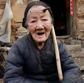 Dünyanın en garip hastalıkları 65