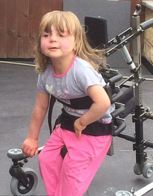 Dünyanın en garip hastalıkları 4