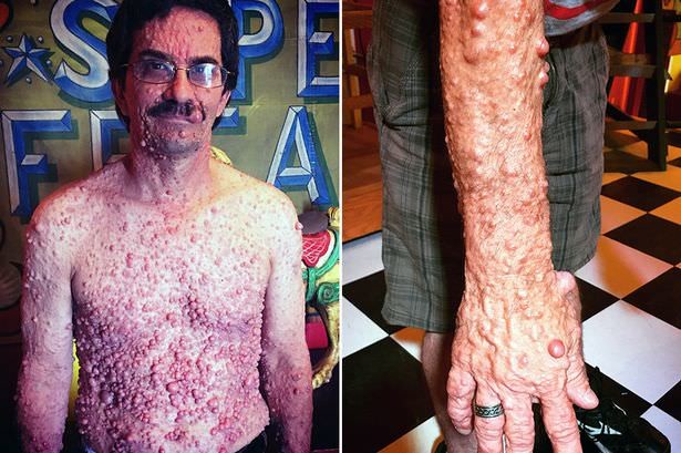 Dünyanın en garip hastalıkları 68