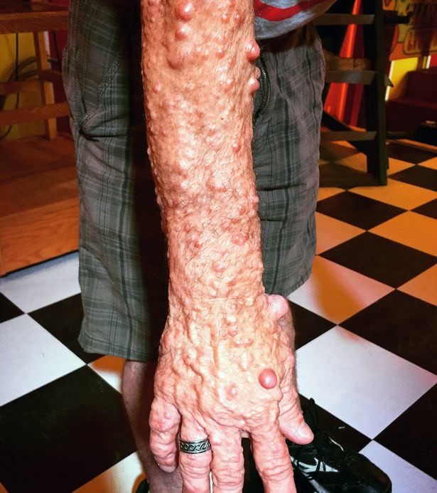 Dünyanın en garip hastalıkları 70