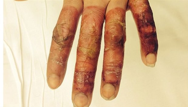 Dünyanın en garip hastalıkları 75