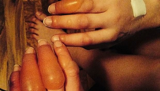 Dünyanın en garip hastalıkları 76