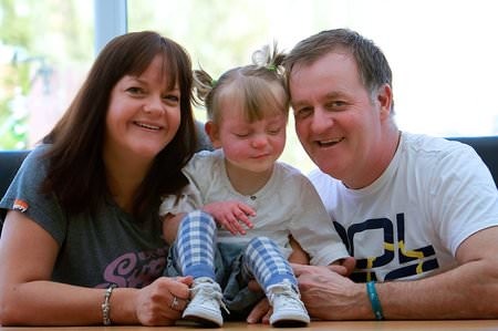 Dünyanın en garip hastalıkları 5