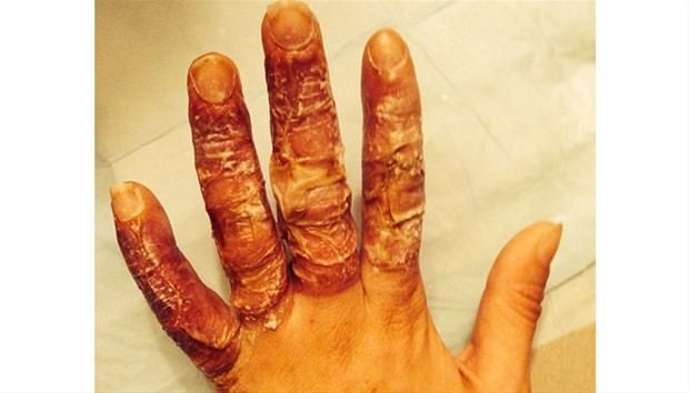 Dünyanın en garip hastalıkları 77