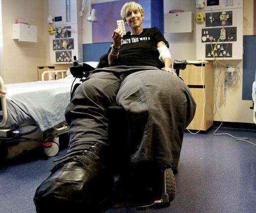 Dünyanın en garip hastalıkları 78