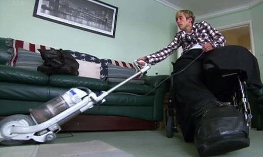 Dünyanın en garip hastalıkları 80