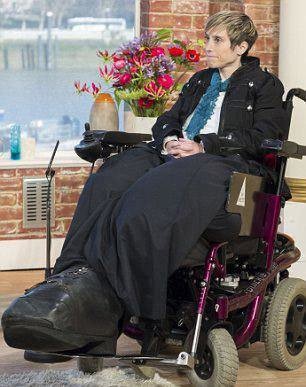 Dünyanın en garip hastalıkları 81