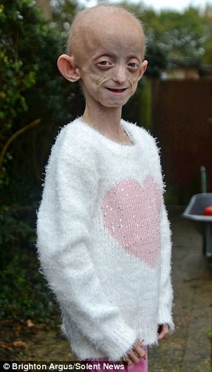 Dünyanın en garip hastalıkları 83