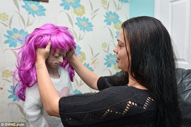 Dünyanın en garip hastalıkları 84