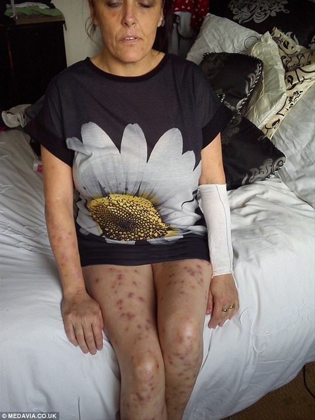 Dünyanın en garip hastalıkları 85