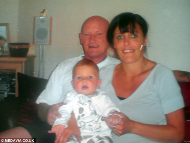 Dünyanın en garip hastalıkları 86