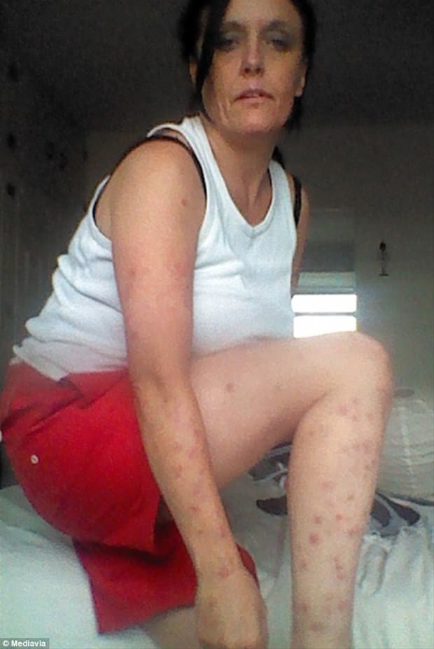 Dünyanın en garip hastalıkları 87