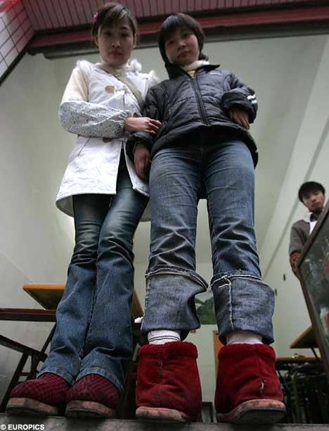 Dünyanın en garip hastalıkları 89