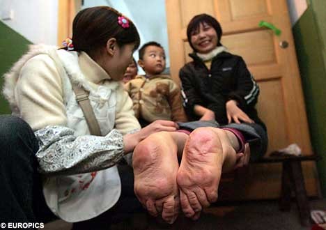 Dünyanın en garip hastalıkları 91