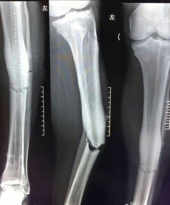 Demba Ba'nın hayatındaki en kritik 3 saat 5