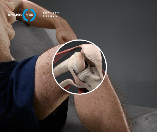 İşte trafik kazalarına dayanıklı insan: Graham 5