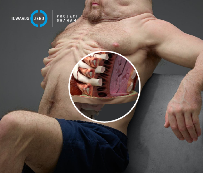 İşte trafik kazalarına dayanıklı insan: Graham 6