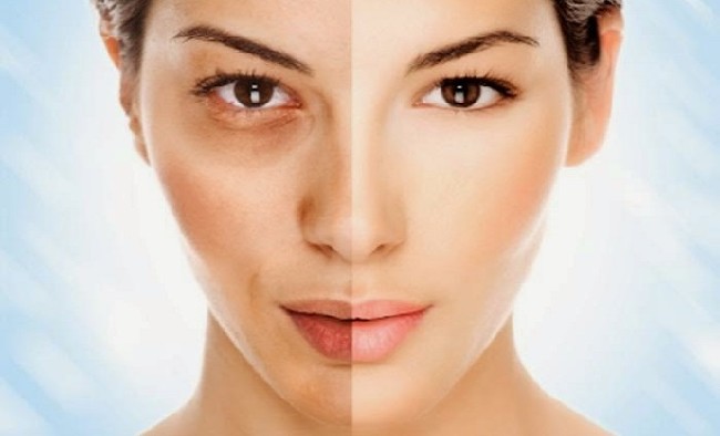 Güneş lekelerine karşı 5 etkili çözüm 18