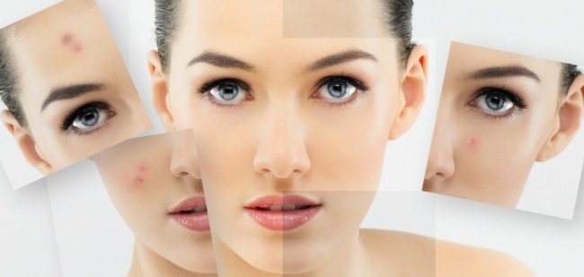 Güneş lekelerine karşı 5 etkili çözüm 21