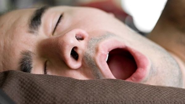 Horlama nasıl tedavi edilir? 9