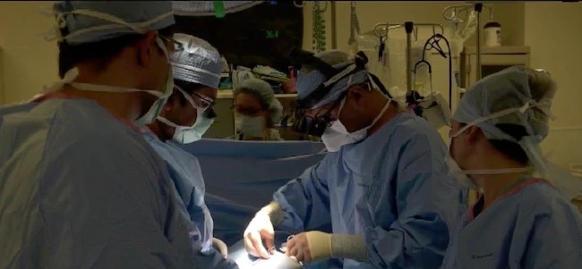 Kalbinden yapışık ikizler 2