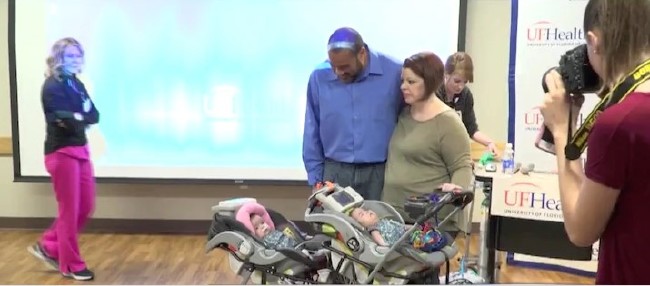 Kalbinden yapışık ikizler 6