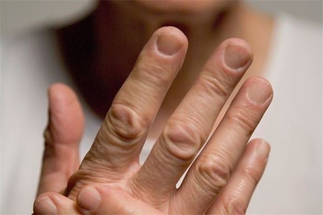 Tırnak şekline göre insan kişiliği 4