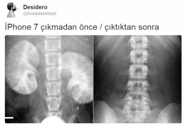 Güldüren iPhone 7 capsleri 15