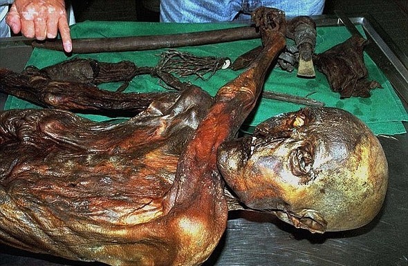 Tıp dünyasına umut kaynağı oldu 2