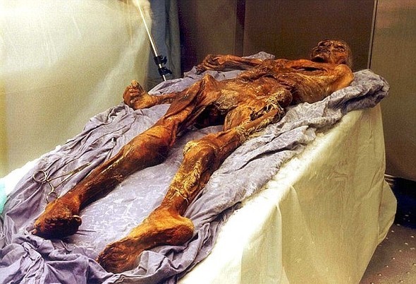 Tıp dünyasına umut kaynağı oldu 3