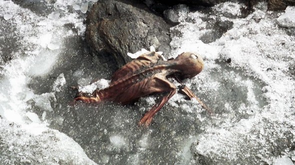 Tıp dünyasına umut kaynağı oldu 9